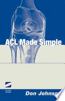 The ACL made simple /