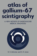 Atlas of gallium-67 scintigraphy ; a new method of radionuclide medical diagnosis /