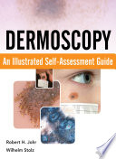 Dermoscopy : an illustrated self assessment guide /