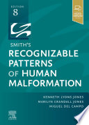 Smith's recognizable patterns of human malformation /