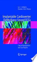 Implantable cardioverter defibrillator stored ECGs : clinical management and case reports /
