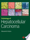Pathology of hepatocellular carcinoma /