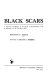 Black scars ; a rigorous investigation of the effects of discrimination, with an appendix on the Southern white /