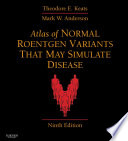 Atlas of normal roentgen variants that may simulate disease /