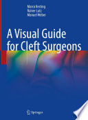 A Visual Guide for Cleft Surgeons /