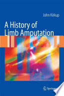 A history of limb amputation /