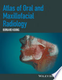 Atlas of Oral and Maxillofacial Radiology.