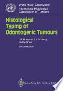 Histological typing of odontogenic tumours /