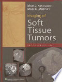 Imaging of soft tissue tumors /