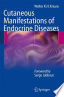 Cutaneous manifestations of endocrine diseases /