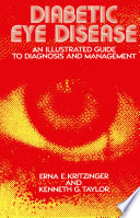 Diabetic Eye Disease : an Illustrated Guide to Diagnosis and Management /