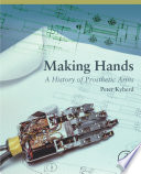 Making hands : a history of prosthetic arms /