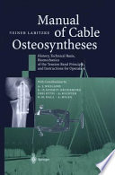 Manual of Cable Osteosyntheses : History, Technical Basis, Biomechanics of the Tension Band Principle, and Instructions for Operation /