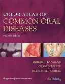 Color atlas of common oral diseases /