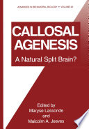 Callosal Agenesis : a Natural Split Brain? /