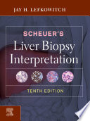 Scheuer's liver biopsy interpretation /