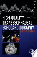 High-quality transesophageal echocardiography/