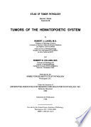 Tumors of the hematopoietic system /