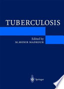 Tuberculosis /