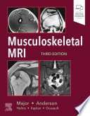 Musculoskeletal MRI /