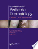 Illustrated manual of pediatric dermatology : diagnosis and management /