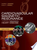 Cardiovascular magnetic resonance : a companion to Braunwald's heart disease /