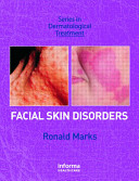 Facial skin disorders /
