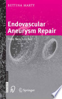 Endovascular aneurysm repair : from bench to bed /