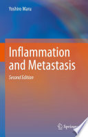 Inflammation and Metastasis /
