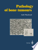 Pathology of bone tumours : Personal experience /