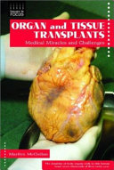 Organ and tissue transplants : medical miracles and challenges /