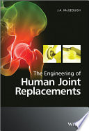 The engineering of human joint replacements /