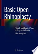 Basic Open Rhinoplasty : Principles and Practical Steps for Surgeons in Training /