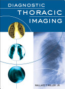 Diagnostic thoracic imaging /