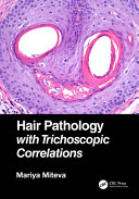 Hair pathology with trichoscopic correlations /