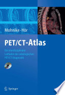 PET/CT-Atlas : ein interdisziplinärer Leitfaden der onkologischen PET/CT-Diagnostik /