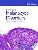 Pathology of melanocytic disorders /