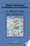 Biopsy pathology of melanocytic disorders /