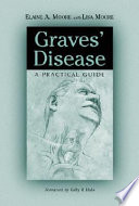 Graves' disease : a practical guide /