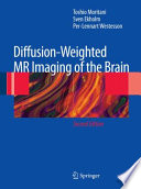 Diffusion-weighted MR imaging of the brain /