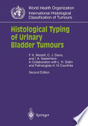 Histological Typing of Urinary Bladder Tumours /
