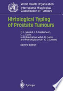 Histological typing of prostate tumours /