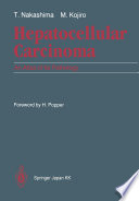 Hepatocellular carcinoma : an atlas of its pathology /