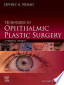 Techniques in ophthalmic plastic surgery : a personal tutorial /