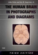 The human brain in photographs and diagrams /