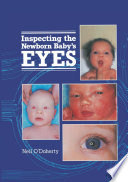 Inspecting the newborn baby's eyes /