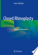 Closed Rhinoplasty : The Next Generation /