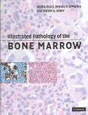 Illustrated pathology of the bone marrow /