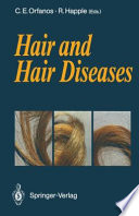 Hair and Hair Diseases /