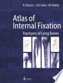 Atlas of internal fixation : fractures of long bones : classification, statistical analysis, technique, radiology /